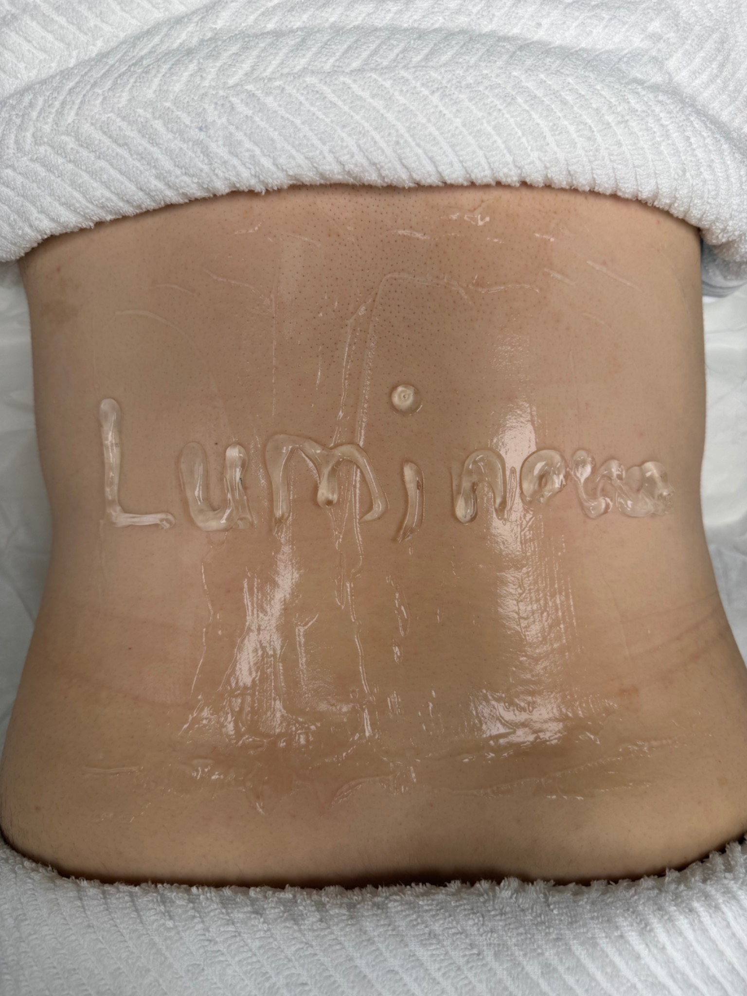 Luminova body laser treatment preparation
